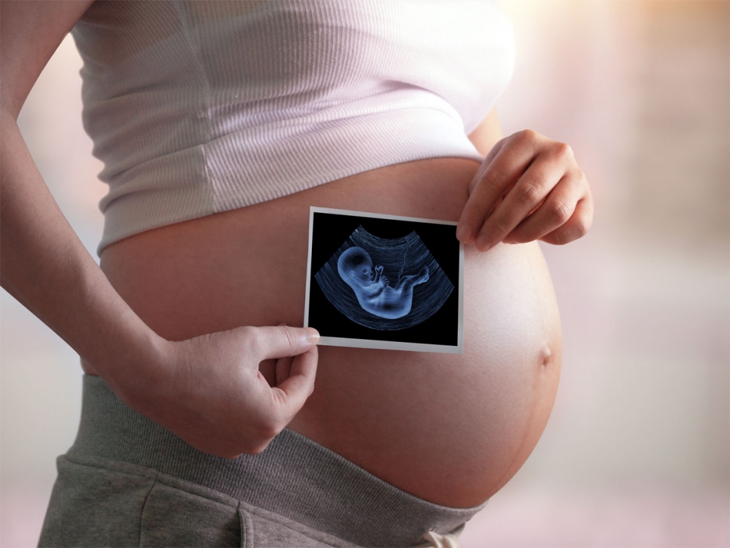 El Diagnostico Prenatal Toda La Seguridad Para La Madre Y El Bebe Antes Del Parto Avantmedic